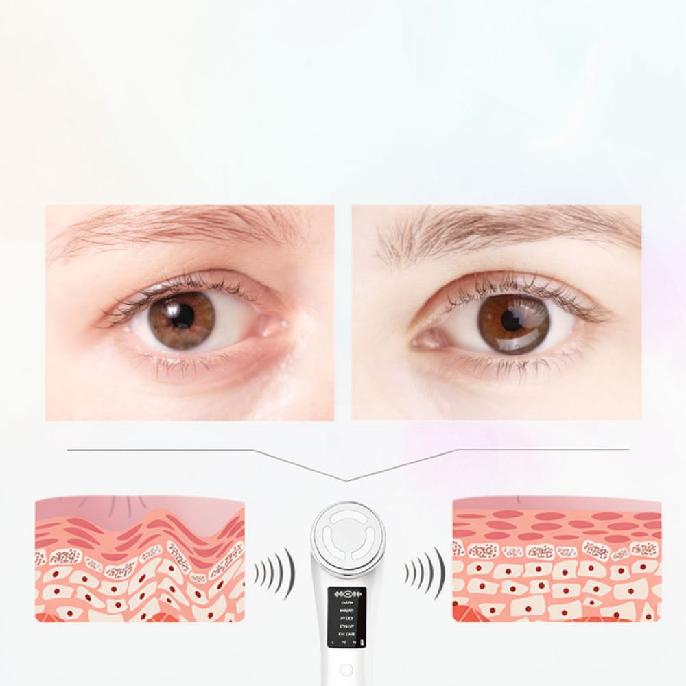 เครื่องนวดบำรุงผิวหน้าระดับมือ - Photon Light Therapy Device Skin บทวิจารณ์และราคา