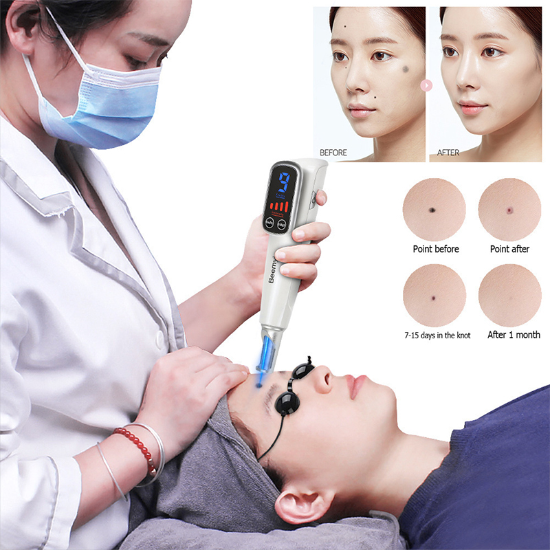 # เครื่องเลเซอร์พิโคเซคอนด์แบบ - Blue Light Therapy Pen Acne Spot บทวิจารณ์และราคา