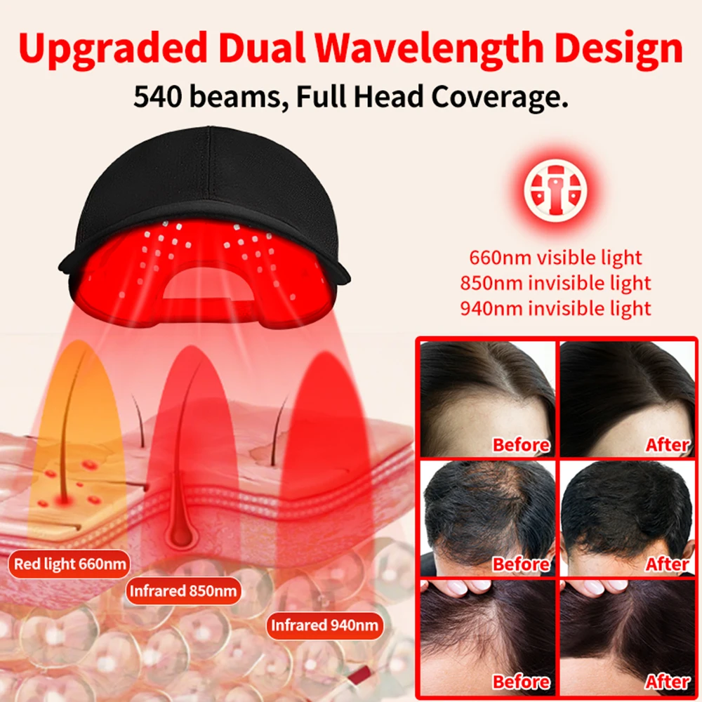 180 ชิ้นไฟ LED อินฟราเรด 660nm - Red Light Therapy Torch 660Nm บทวิจารณ์และราคา